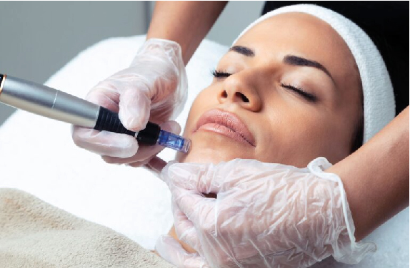 Exosomas con Dermapen